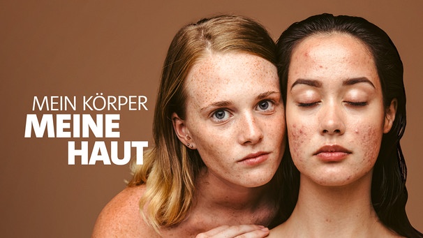 Zwei junge Frauen, Gesicht an Gesicht. Junge Frau links mit geöffneten Augen und makelloser Haut. Rechts junge Frau mit geschlossenen Augen und Akne.  | Bild: stock.adobe.com/Jacob Lund;  Montage: BR