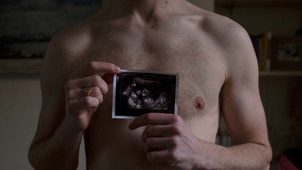 Freddy, schwanger, mit einem Ultraschall-Bild seines Kindes. | Bild: BR/WDR/Danny Burrows