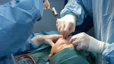 Patientin bei einer Nasen-OP (Symbolbild) | Bild: picture-alliance/dpa/BSIP/A. NOOR