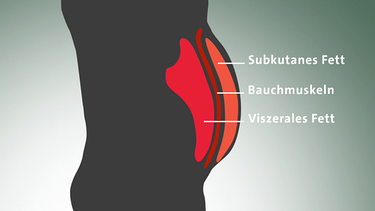 Grafik: Subkutanes Fett, Bauchmuskeln, Viszeralfett | Bild: BR