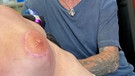 Brustwarzen-Tattoo nach Brustkrebs-OP | Bild: Andy Engel