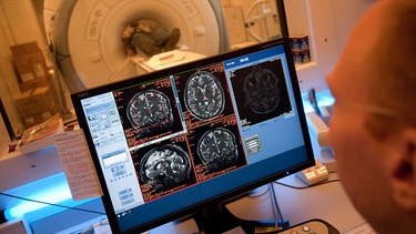 Ein Laborant sitzt am Sonntag (27.11.2011) in der Uniklinik Großhadern in München (Oberbayern) vor einem Bildschirm mit Aufnahmen eines MRT vom Gehirn des Probanden, der im Hintergrund im MRT-Gerät liegt. Der Mann hatte zuvor an einer simulierten Reise zum Mars teilgenommen. Nach 17 Monaten Isolation hatten die sechs Probanden das Forschungsmodul, in dem sie virtuell zum Mars geflogen waren, Anfang November 2011 wieder verlassen. In Großhadern wurden nun die Auswirkungen der Isolation auf ihr Gehirn untersucht. | Bild: picture-alliance/dpa    Andreas Gebert dpa/lby 