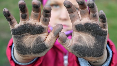 Ein Kind streckt seine dreckingen Hände in die Kamera. | Bild: picture-alliance/dpa