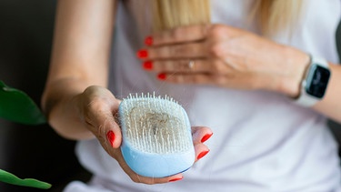 Eine Frau hält eine Plastikhaarbürste in der Hand, in der sich viele ausgefallene Haare befinden | Bild: mauritius images / Alina Buzunova / Alamy / Alamy Stock Fotos