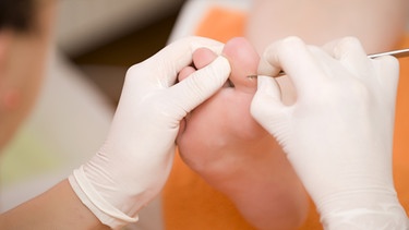 Ein medizinischer Rußpfleger entfernt Hornhaut an einem Fuß | Bild: picture-alliance/dpa