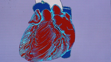 Herz mit Herzkranzgefäßen, Hohlvene, Pulmonalarterie und Aortenbogen, Aorta mit Herzkranzgefäßen als Computergrafik | Bild: picture-alliance/dpa